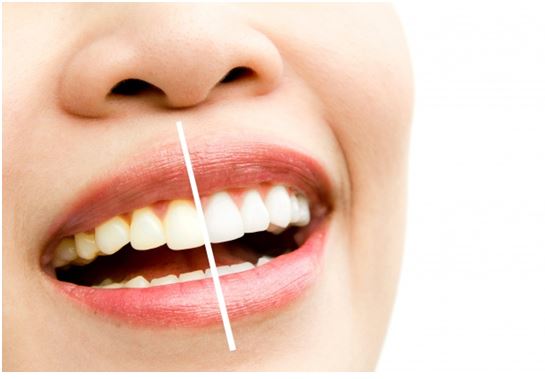 Can Fillings Look Like Your Natural Teeth? - TruCare Dentistry